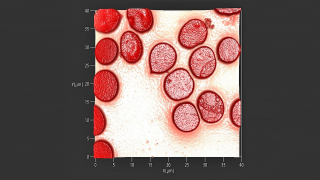 Topography image of erythrocytes (red blood cells)
